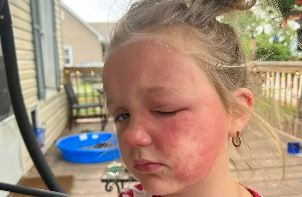 Midwest Mom Issues Warning About Very Dangerous Wild Plant [PHOTOS]