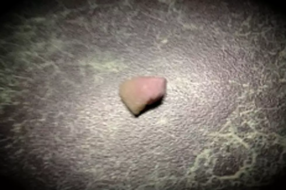 That Moment When You Sit Down at Your Desk at Work and Find a Loose Tooth.