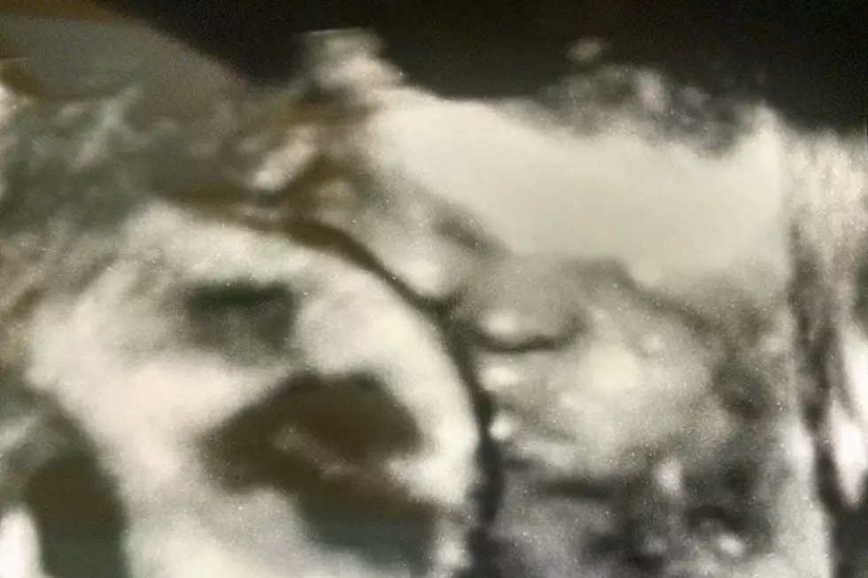 The First 3-D Image of Baby Pants