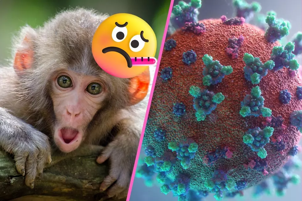Monkeypox Case Confirmed in Massachusetts – But WTF is Monkeypox?