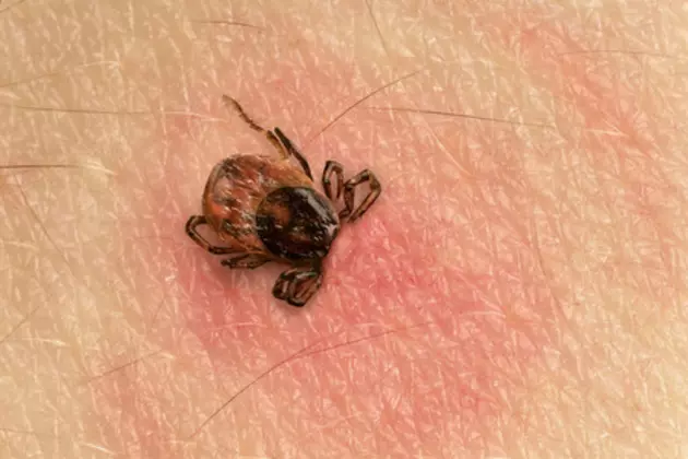 Maine Is Invaded by Ticks, but a Vaccine Against Lyme Disease May Be Close