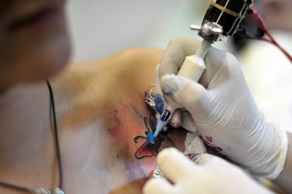 Here’s How to Remove a Tattoo [VIDEO]