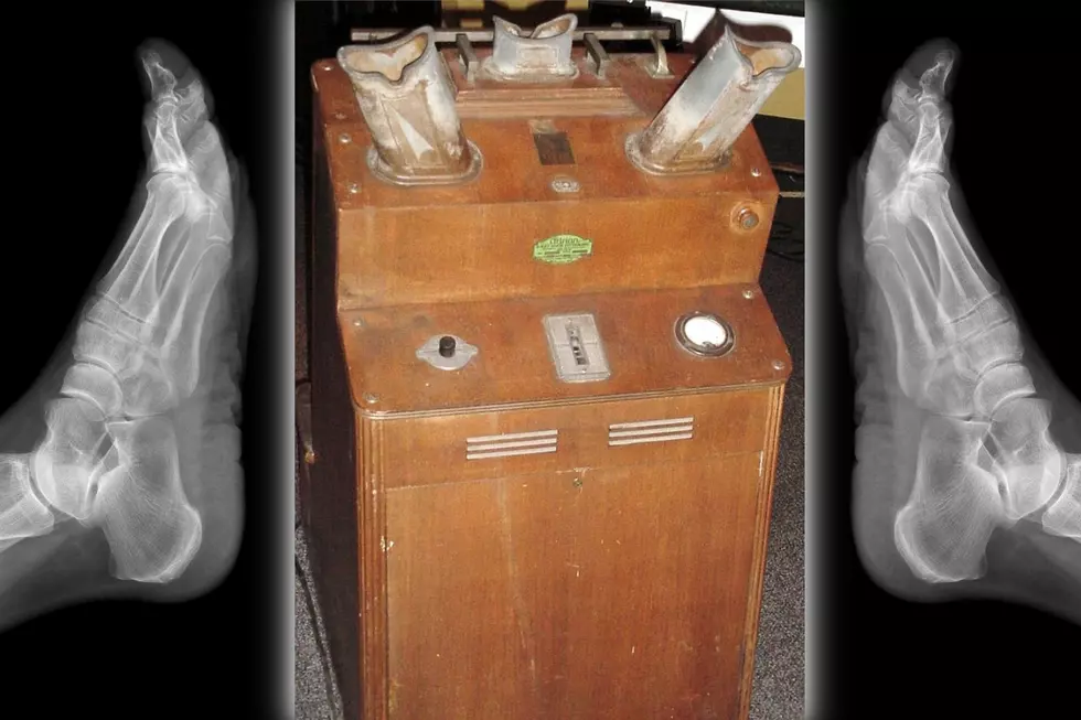 Indiana Department Stores Once Used X-Ray Machines on Kids to Determine Proper Shoe Fit