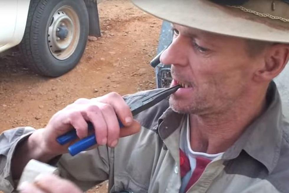 Real-Life Crocodile Dundee Demonstrates Outback Dentistry