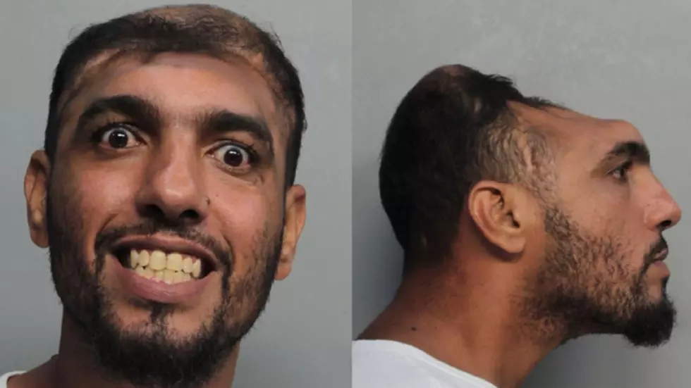 &#8220;Half-Headed&#8221; Florida Man Arrested for Arson and Attempted Murder