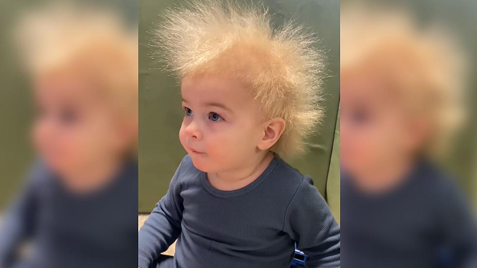 Child With “Uncombable Hair Syndrome” Becomes Internet Sensation