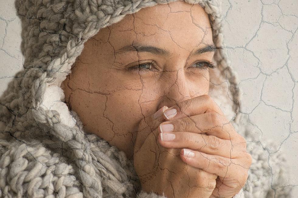 Hey Illinois: These Are Best Ways to Battle Dry, Itchy Winter Skin
