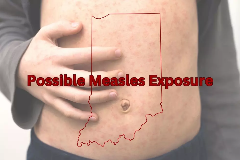 Possible Measles Exposure at Indianapolis Children's Museum