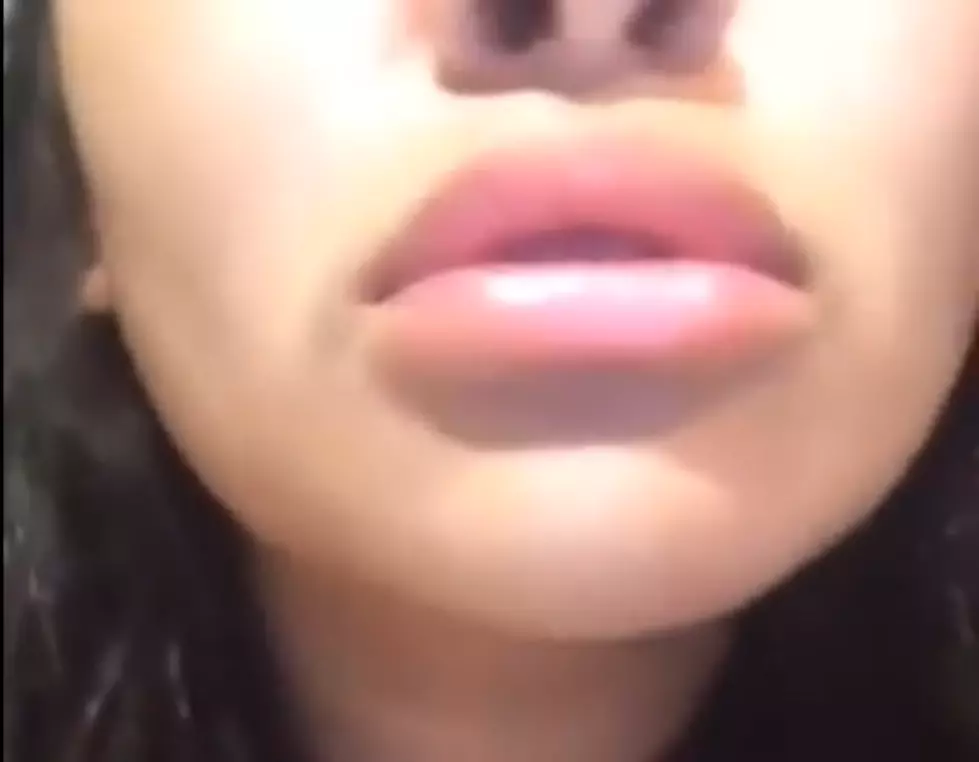 Ridiculous Attempt At Big Lips