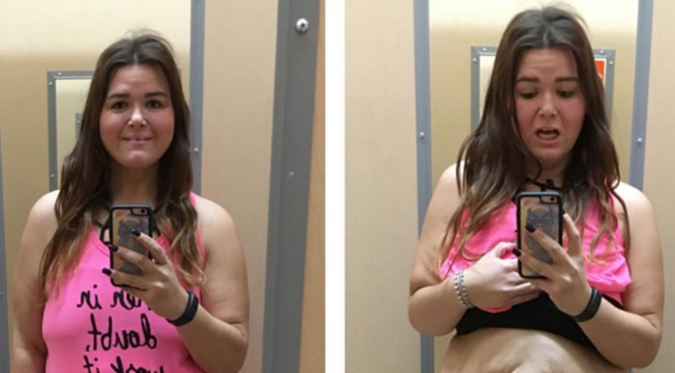 Illinois Woman’s Stunning Weight Loss Photos Go Viral