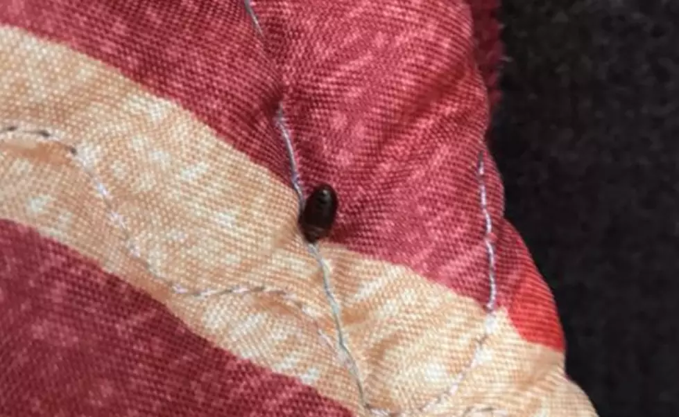 Woman Furious Over Bed Bug Infestation At Wisconsin Dells Resort