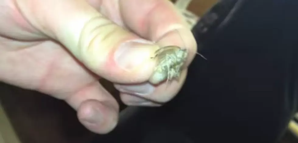 Man Has Moth Stuck in Ear [NSFW VIDEO]