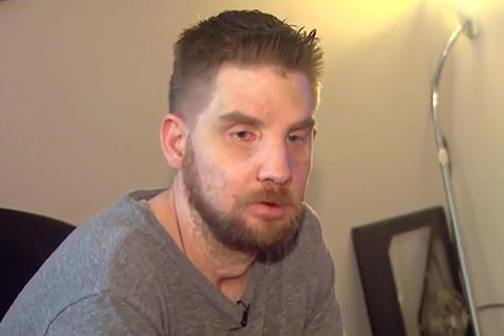 Face Transplant Recipient Speaks Out on Harrowing Ordeal