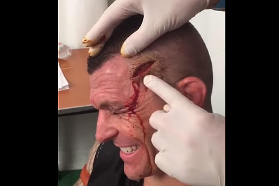 Kickboxer's Gross Head Wound Has a Voice of Its Own