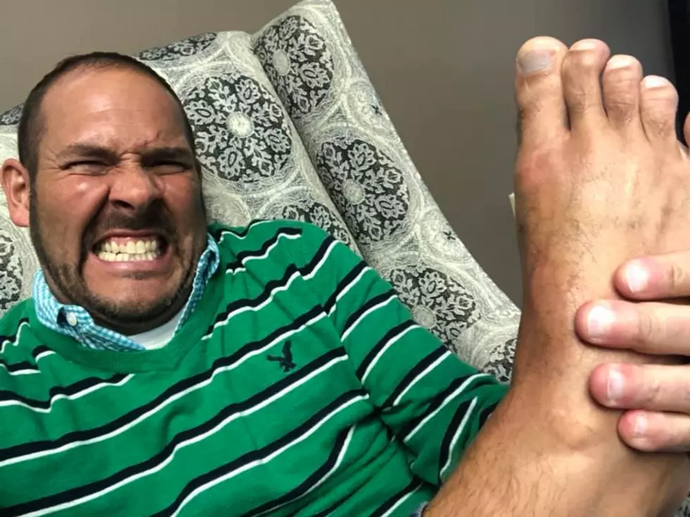 WBKR Listeners Share Their Personal Gout Remedies