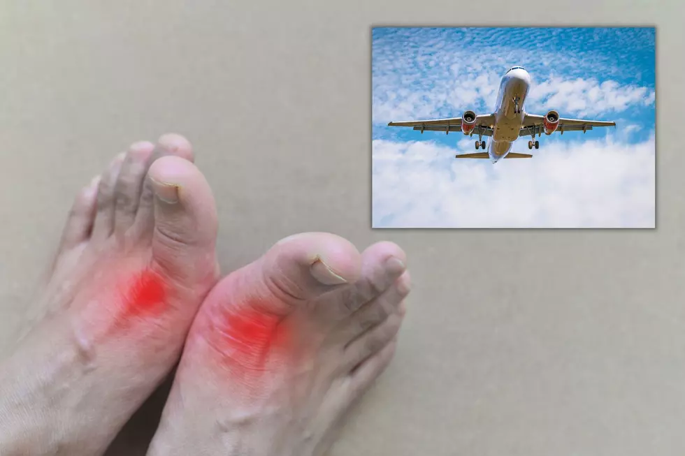 Kentucky Man Wants to Know- Can Flying Cause a Gout Flare?