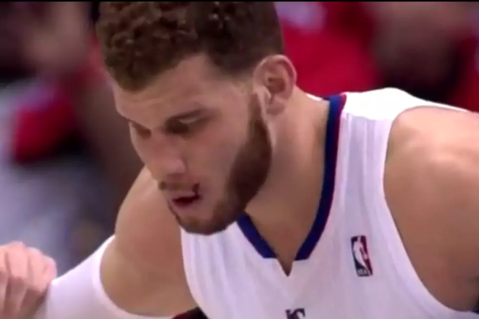 Blake Griffin’s Tooth Goes Through His Lip [VIDEO]