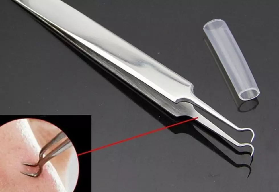 This Blackhead Extraction Tool Will Either Give You Great Satisfaction or Make You Ralph [VIDEO]