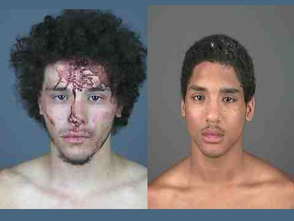 Another Awesome Albany Mugshot – Shirtless, Bloody Face, and Wild Hair