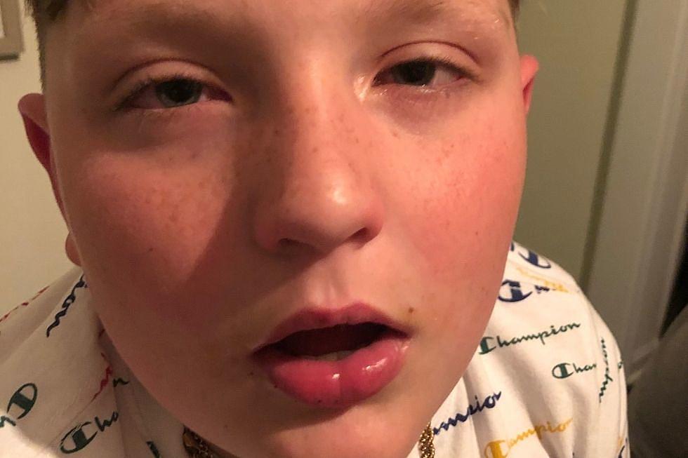 Ryan&#8217;s Allergies Are Brutal This Season &#8211; Here&#8217;s Why