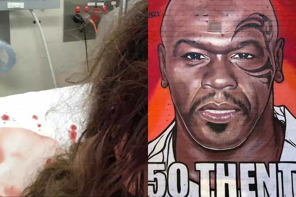 Artist Behind 50 Cent Celebrity Paintings Hospitalized After Being Physically Attacked