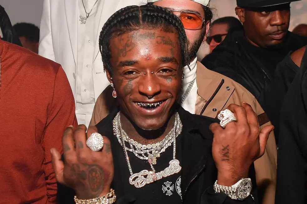 Photo Surfaces of Lil Uzi Vert’s Multimillion Dollar Pink Diamond Implanted in His Forehead