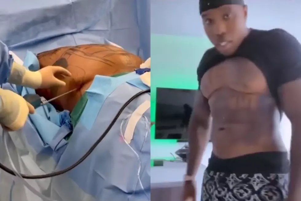 Bandman Kevo Gets Liposuction for His Abs, Hints That Other Rappers Have Done It