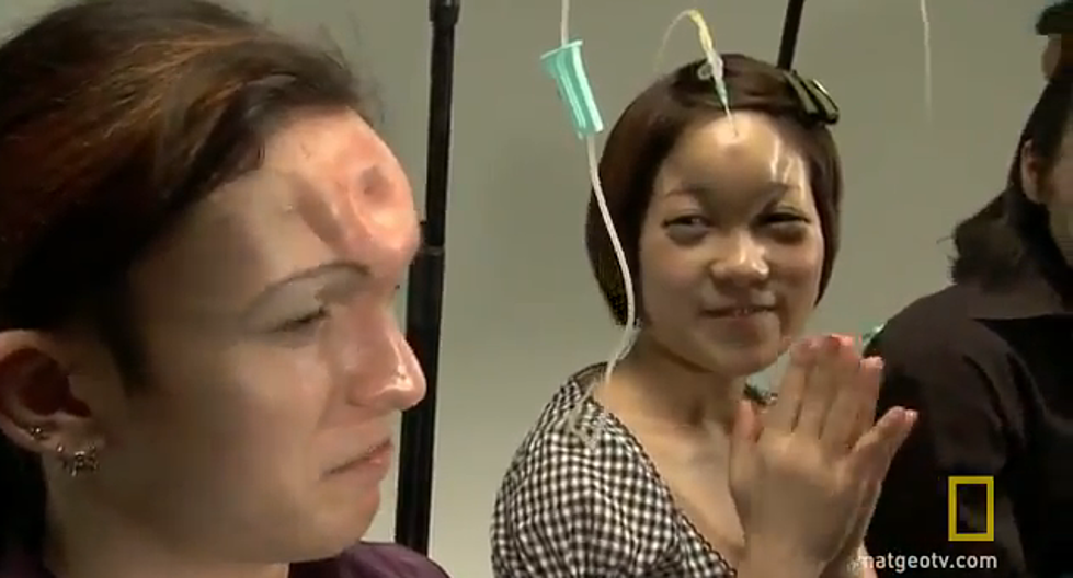 Bagel Heads &#8211; The Stupid New Trend in Body Modification [VIDEO]