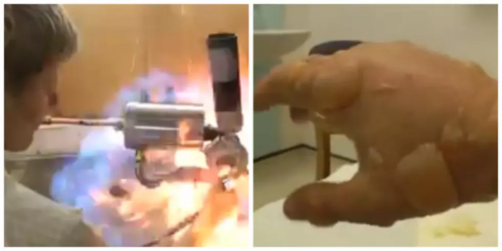Inventor Creates a Horrific and Disgusting Burn on Accident [VIDEO]