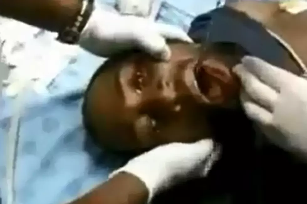 Doctors Remove Cell Phone From Man&#8217;s Throat [VIDEO]