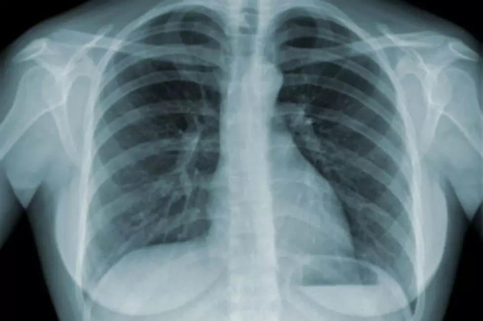 Woman Becomes First Person in The World to Live 6 Days Without Lungs [VIDEO]