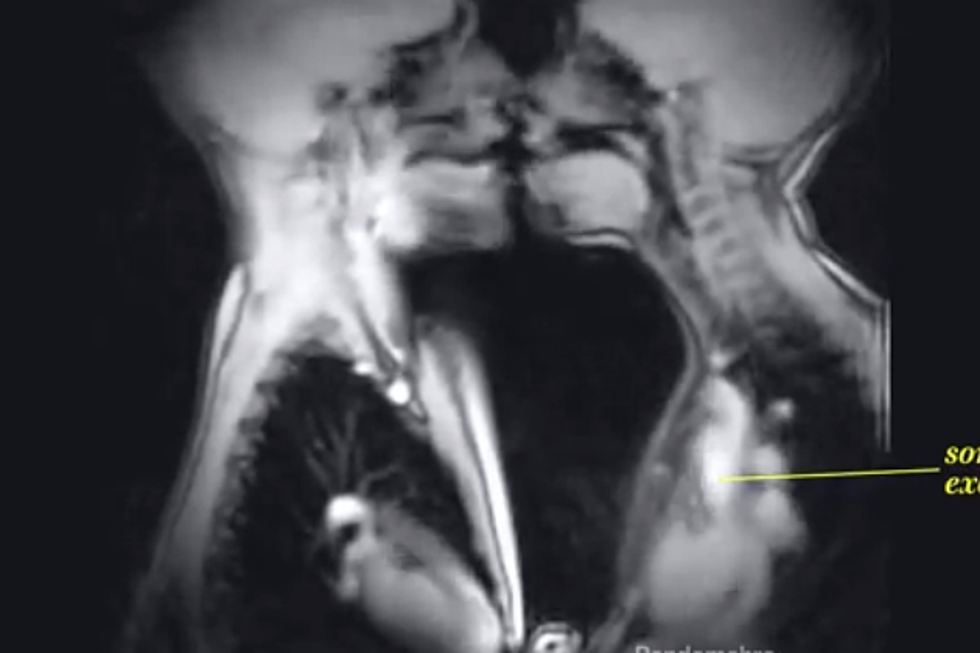 This Is What Sex Looks Like Inside An MRI Scanner [VIDEO]