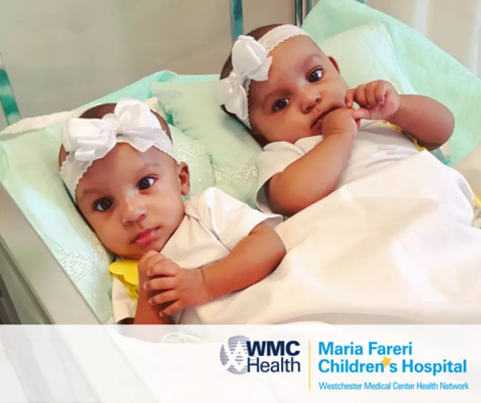 Conjoined Twins Separated In Historic Surgery In Lower Hudson Valley