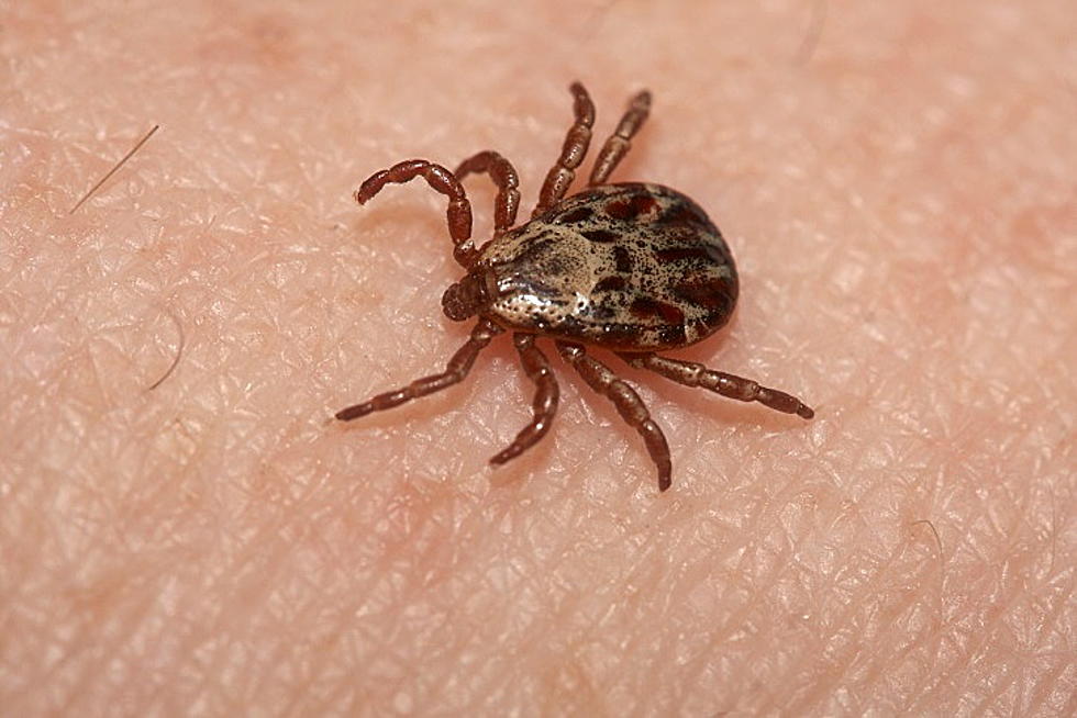 How To Protect Yourself From Ticks In The Hudson Valley