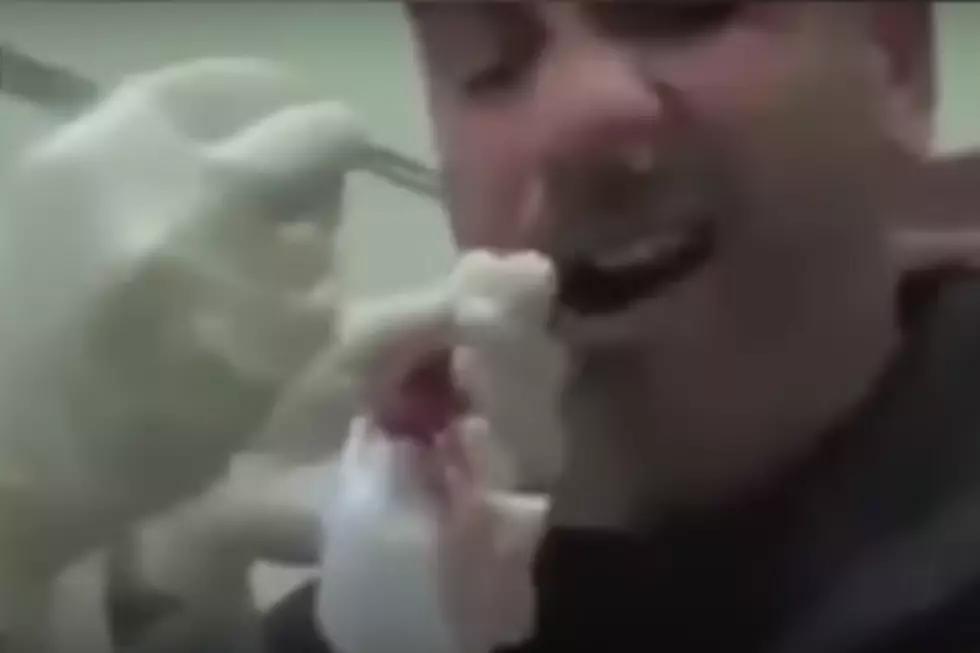 Doctor Pulls Five Foot Tapeworm From Man&#8217;s Nose [NSFW VIDEO]