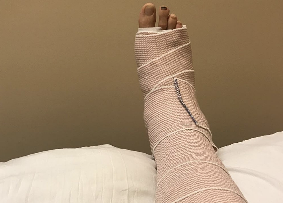 A Pro Runner Broke his Ankle in a Pothole During the Crim