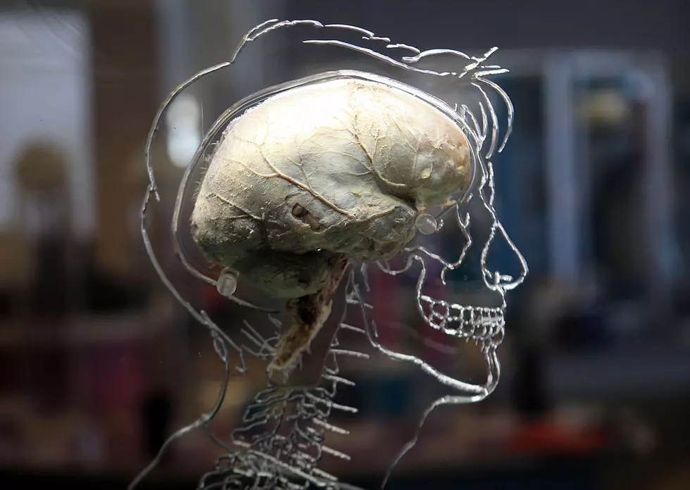 Human Brain in a Jar Found at Canadian/Michigan Border 