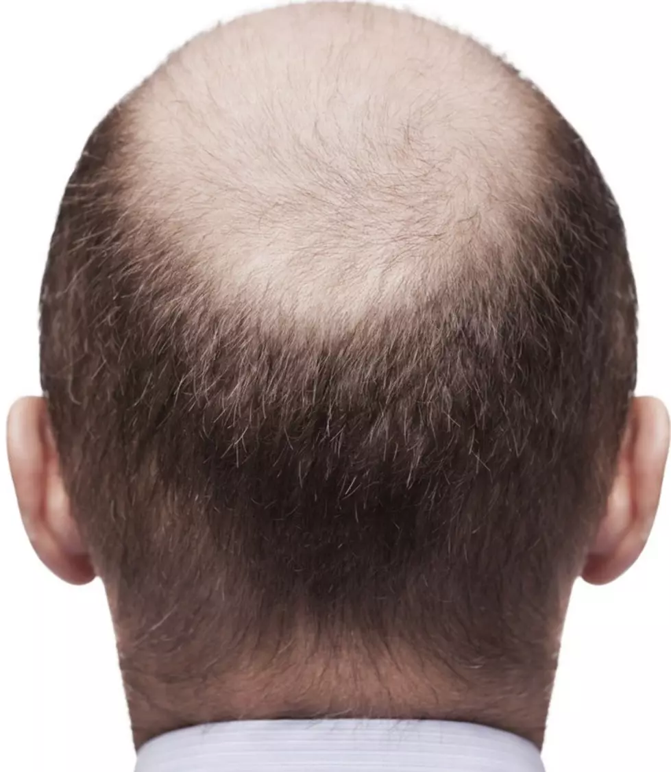 Berkshire Men! Doing This Once A Day Increases Your Baldness Risk
