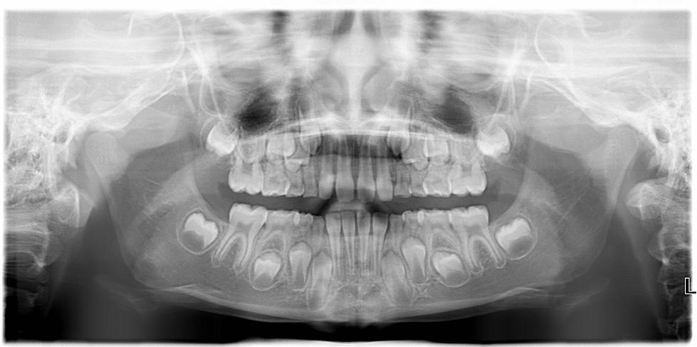 Dentist In Mass. Discovers Freakish Reality On X-Ray