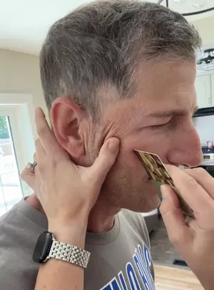 Enormous Stinger Removed From New York State Man’s Face