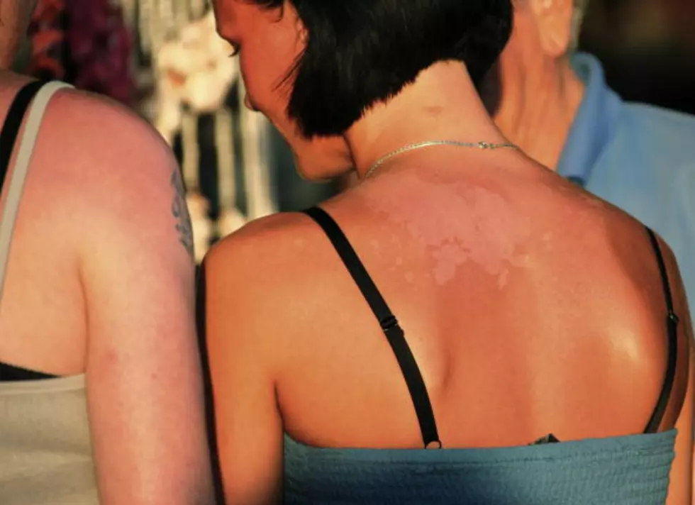 Stop A ‘Steamboat Sunburn’ Before Cheyenne Frontier Days