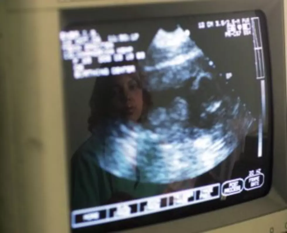 Bill: Drs Must Give Chance To See Fetus Before Abortion [AUDIO]