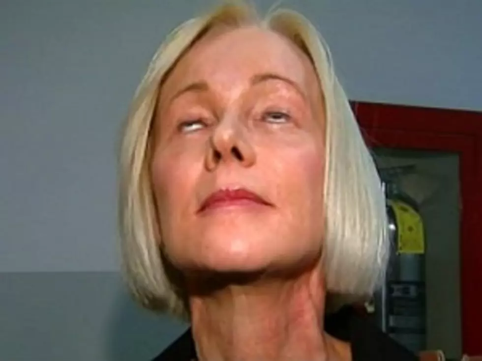 Woman Suing Plastic Surgeon&#8211;Can&#8217;t Close Eyes (VIDEO)