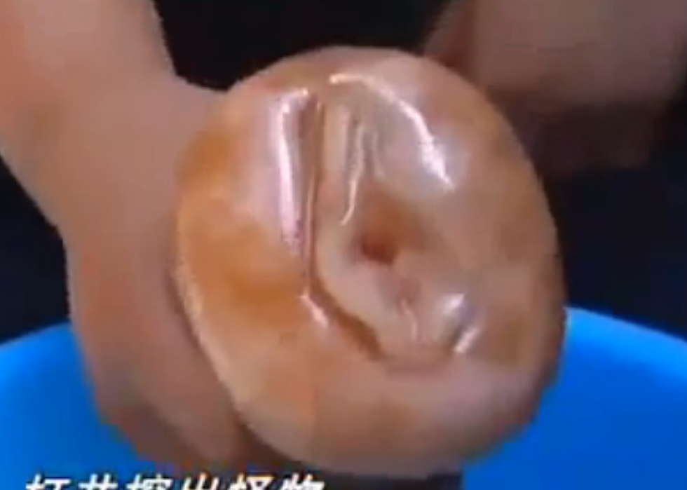 Chinese Village Mistakes Adult Toy for Rare Mushroom