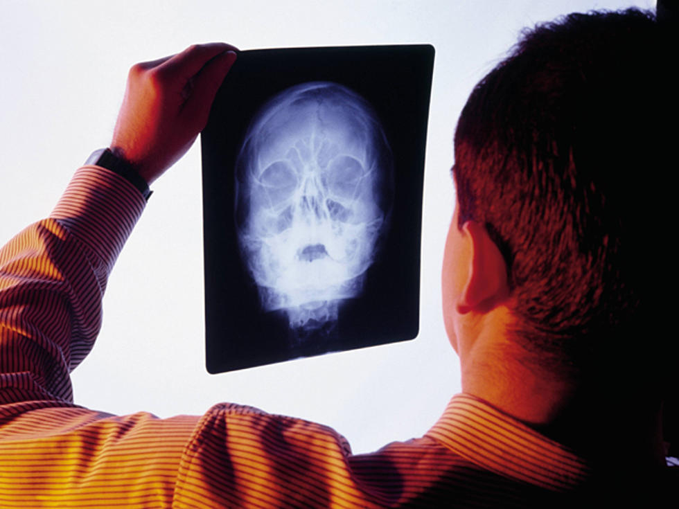 Study Reveals Head Trauma May Increase Likelihood of Alzheimer’s