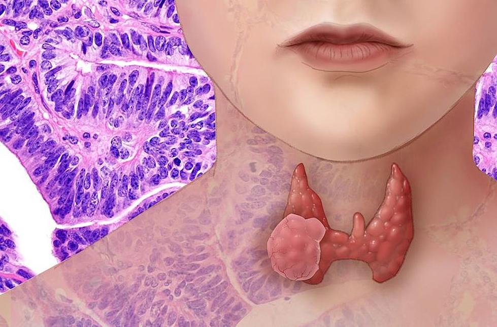 To Your Health: Take care of your thyroid