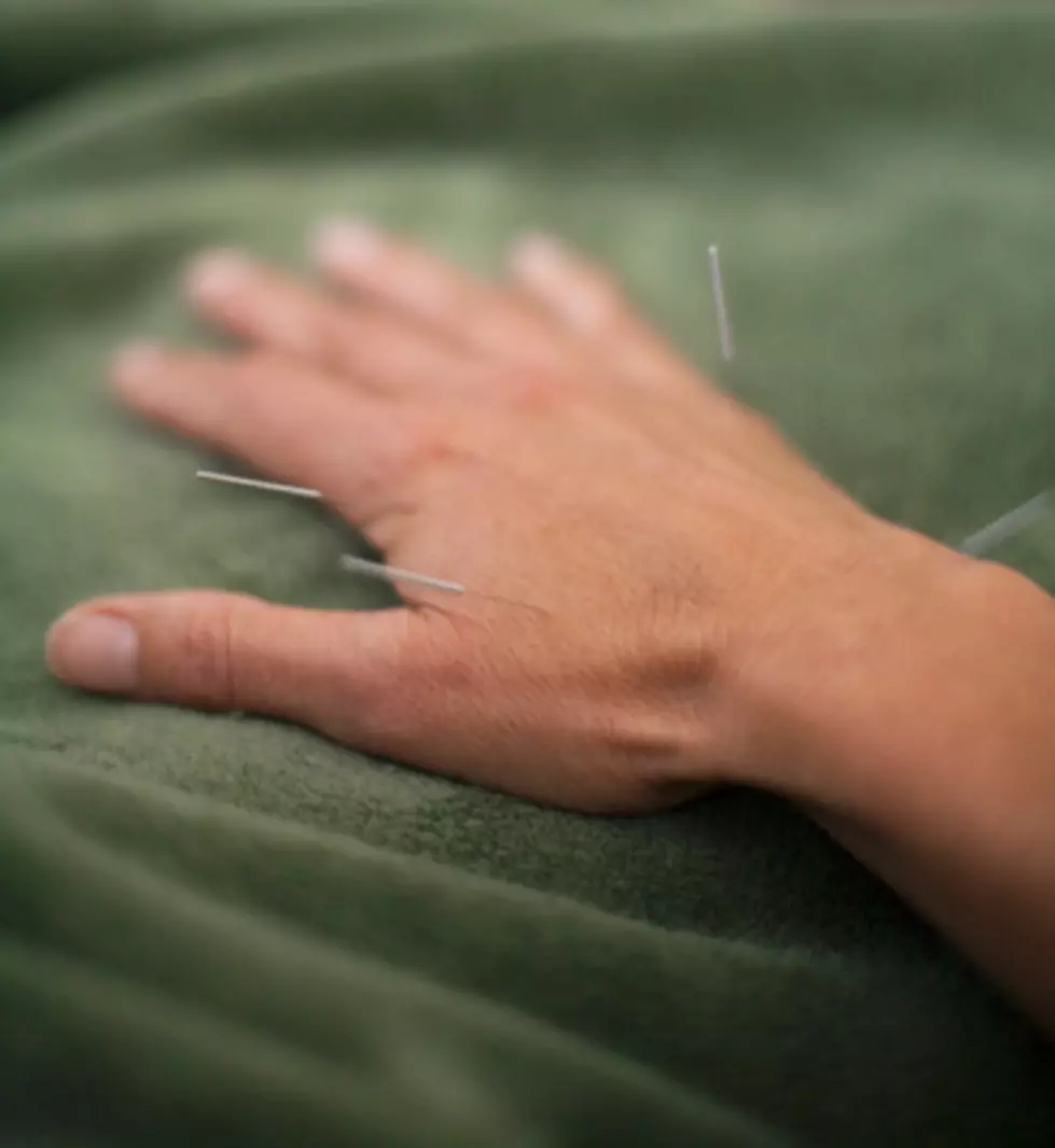 After the Pokes – One Day Later Did Acupuncture Help?