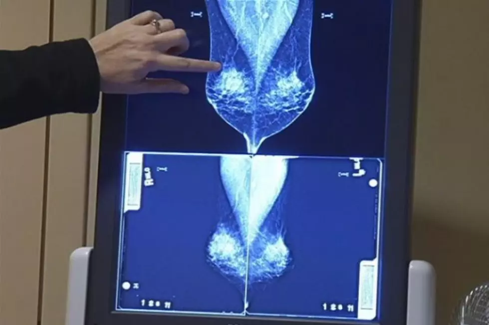 New Breast Screening Machines Give Doctors Faster and Cleaner Images