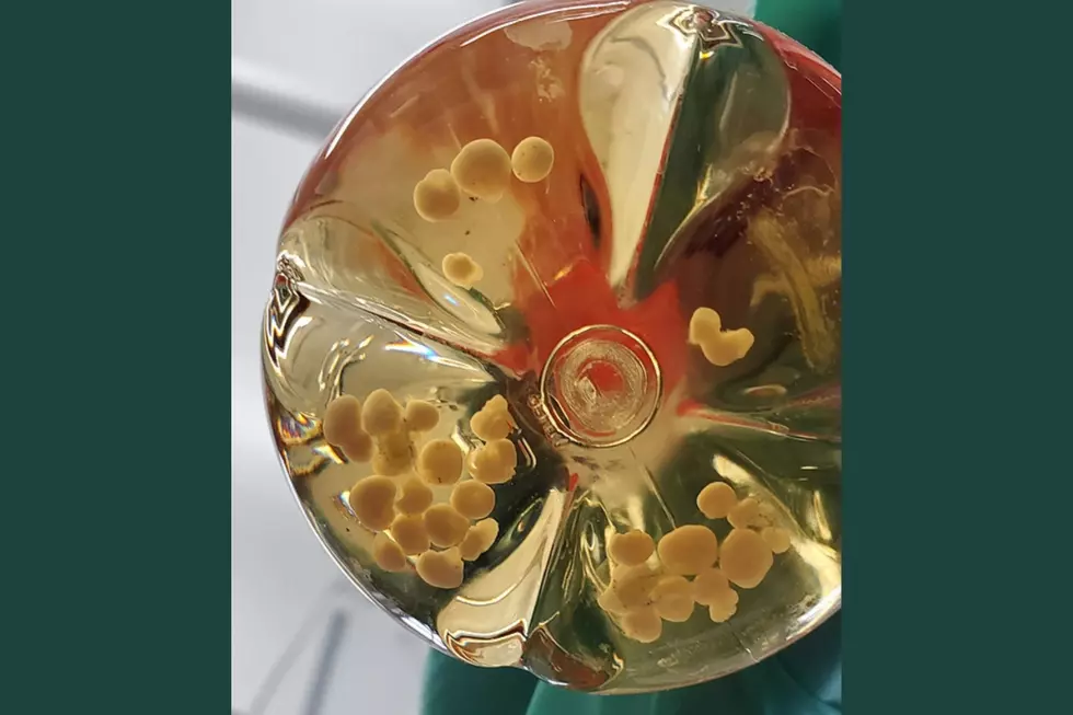 Cerebral organoid-NIH/Canva