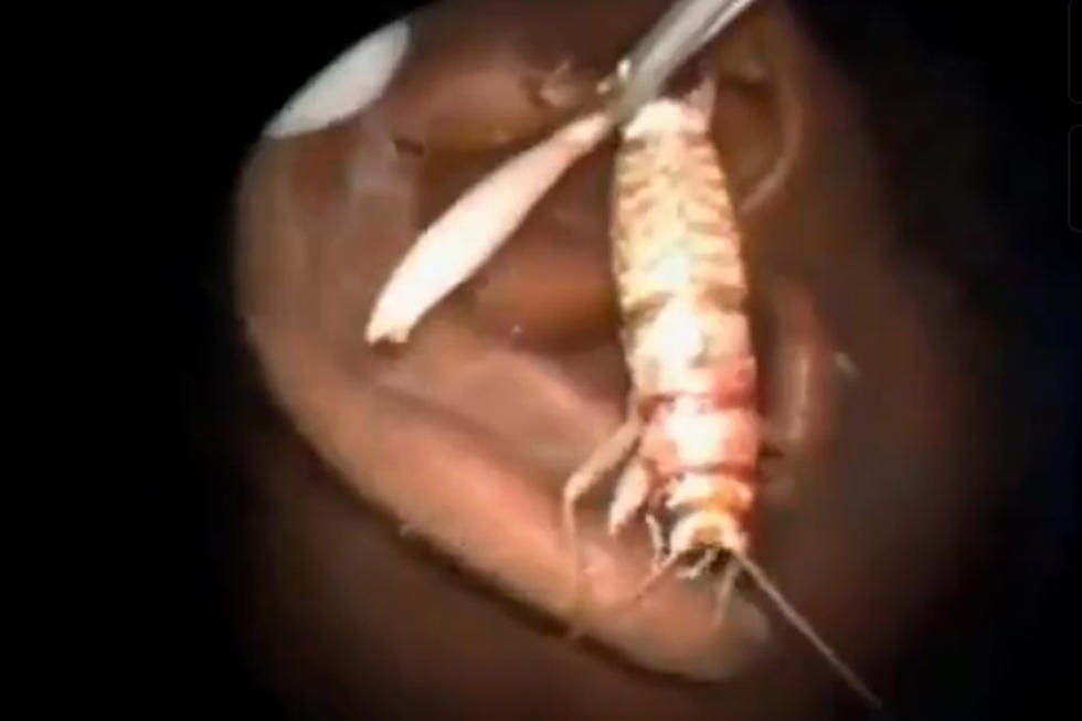 Let’s Remove the Giant Cricket Living in that Boys Ear [VIDEO] NSFL